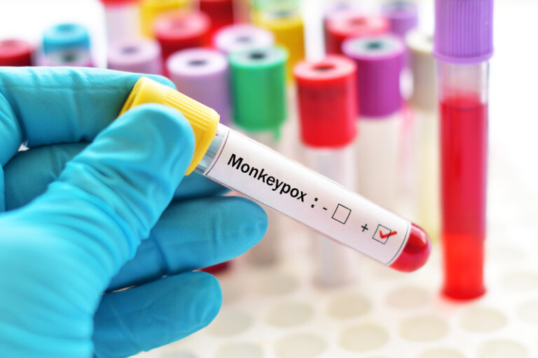 Mayo Clinic to begin Monkeypox testing increasing nationwide testing capacity